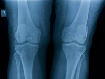 Unblutiges Chirurgieren bei z.B. Arthrose der Gelenke, Deformationen der Wirbel und körperlichen Schmerzen aller Art